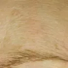 Business 1 image ABOUT FACE ELECTROLYSIS, IPL & BEAUTY CLINIC LTD Skin Care in Glasgow Glg