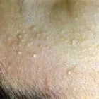 Business 4 image ABOUT FACE ELECTROLYSIS, IPL & BEAUTY CLINIC LTD Skin Care in Glasgow Glg
