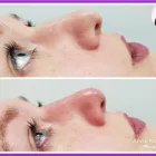 Business 2 image AESTHETICS AND BEAUTY BY ANNE Spa Services in Leicester Le