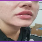 Business 3 image AESTHETICS AND BEAUTY BY ANNE Spa Services in Leicester Le