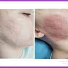 Business 5 image AESTHETICS AND BEAUTY BY ANNE Spa Services in Leicester Le