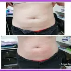 Business 6 image AESTHETICS AND BEAUTY BY ANNE Spa Services in Leicester Le