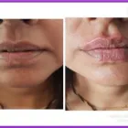 Business 7 image AESTHETICS AND BEAUTY BY ANNE Spa Services in Leicester Le