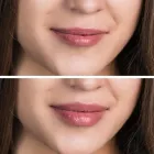 Business 1 image AESTHETICS BY SILVIE Skin Care Clinics in Twickenham Mi