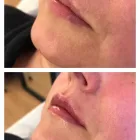 Business 1 image ANGEL AESTHETICS BY RACHEL Skin Care Clinics in ST HELENS Me