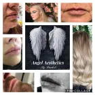 Business 6 image ANGEL AESTHETICS BY RACHEL Skin Care Clinics in ST HELENS Me