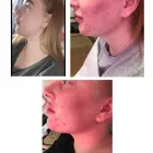 Business 7 image ANGEL AESTHETICS BY RACHEL Skin Care Clinics in ST HELENS Me