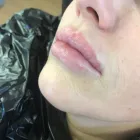 Business 9 image ANGEL AESTHETICS BY RACHEL Skin Care Clinics in ST HELENS Me