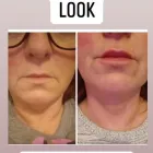 Business 11 image ANGEL AESTHETICS BY RACHEL Skin Care Clinics in ST HELENS Me