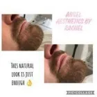 Business 15 image ANGEL AESTHETICS BY RACHEL Skin Care Clinics in ST HELENS Me