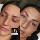 Business 14 image ANGELA FOX PMU & AESTHETICS Plastic & Cosmetic Surgery in Altrincham Ch