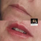 Business 19 image ANGELA FOX PMU & AESTHETICS Plastic & Cosmetic Surgery in Altrincham Ch