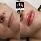 Business 24 image ANGELA FOX PMU & AESTHETICS Plastic & Cosmetic Surgery in Altrincham Ch