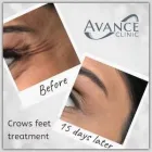 Business 5 image AVANCE CLINIC DERBY Medical Facilities in Derby De