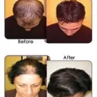 Business 2 image BEAUTY FIRST LASER SKIN CLINIC Electrolysis & Laser Hair Removal in Wolverhampton We