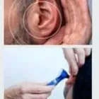 Business 30 image CHESHIRE EAR WAX REMOVAL & MICROSUCTION SERVICES Medical Facilities in Cheadle Ch