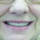 Business 9 image COSMETIC DENTURE CLINIC Dentures in Glasgow La