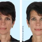 Business 5 image DR ALEX CHAMBERS MEDICAL & AESTHETIC PRACTICE Cosmetic Surgery in London Gr