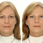 Business 7 image DR ALEX CHAMBERS MEDICAL & AESTHETIC PRACTICE Cosmetic Surgery in London Gr