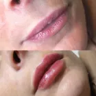 Business 1 image ESTHETICA Plastic & Cosmetic Surgery in Hemel Hempstead He