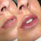 Business 2 image ESTHETICA Plastic & Cosmetic Surgery in Hemel Hempstead He