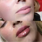 Business 4 image ESTHETICA Plastic & Cosmetic Surgery in Hemel Hempstead He