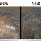 Business 2 image HAIR FIBER Trichologists in Manchester Gr