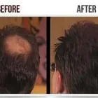 Business 3 image HAIR FIBER Trichologists in Manchester Gr