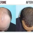 Business 4 image HAIR FIBER Trichologists in Manchester Gr