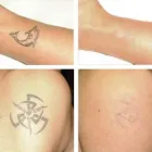 Business 5 image LASER ROOM Tattoo Artists in Congleton Ch