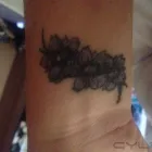 Business 1 image LASERASE BOLTON Skin Care Clinics in Farnworth Gr