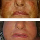 Business 1 image LASERWISE SKIN & BEAUTY CLINIC Tattoo Removal Service in Cardiff Crf