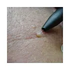 Business 6 image ON THE RIGHT FOOT - FOOT HEALTH PRACTITIONER Foot Health in Leicester Le