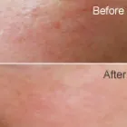 Business 9 image ON THE RIGHT FOOT - FOOT HEALTH PRACTITIONER Foot Health in Leicester Le