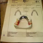 Business 4 image PRECISION DENTAL LABORATORY Denture Repairs in Poole Do