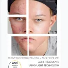 Business 10 image PURE SKIN LOUNGE Tattoo Removal Service in Hemel Hempstead He