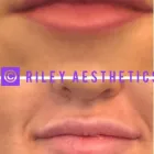 Business 12 image RILEY AESTHETICS Skin Care Clinics in Glasgow Glg