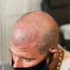 Business 6 image SCALP LINE Tattoo Artists in Hull Ery