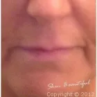 Business 3 image SKIN BEAUTIFUL MEDICAL & COSMETIC CLINIC Skin Care Clinics in Llanelli Dy