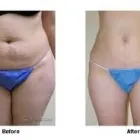 Business 1 image SKINDEEP LASER & BEAUTY Electrolysis & Laser Hair Removal in Coventry We