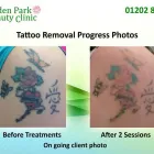 Business 5 image STROUDEN PARK BEAUTY CLINIC Tattoo Artists in Bournemouth Do