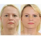 Business 1 image THE CENTRE FOR ADVANCED FACIAL COSMETIC AND PLASTIC SURGERY: DR JULIAN DE SILVA Cosmetic Surgery in London Gr