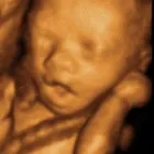 Business 7 image THIS IS MY: HEALTH SCREENING & ULTRASOUND CENTRES Private Clinics in Leeds We