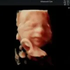 Business 1 image ULTRASOUND CARE LTD Shopping & Retail in Liverpool Me