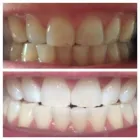 Business 2 image UV3 TANNING Tanning Salons in Ringwood Ha