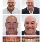 Business 6 image VITALEUROPE DENTIST Orthodontists in London Gr