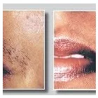 Business 5 image WELLFIELD LASER & BEAUTY Skin Care Clinics in Keynsham So