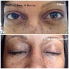 Business 6 image WELLFIELD LASER & BEAUTY Skin Care Clinics in Keynsham So