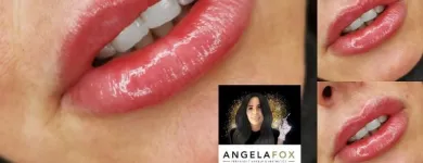 Business 10 image ANGELA FOX PMU & AESTHETICS Plastic & Cosmetic Surgery in Altrincham Ch