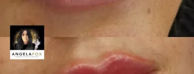 Business 17 image ANGELA FOX PMU & AESTHETICS Plastic & Cosmetic Surgery in Altrincham Ch